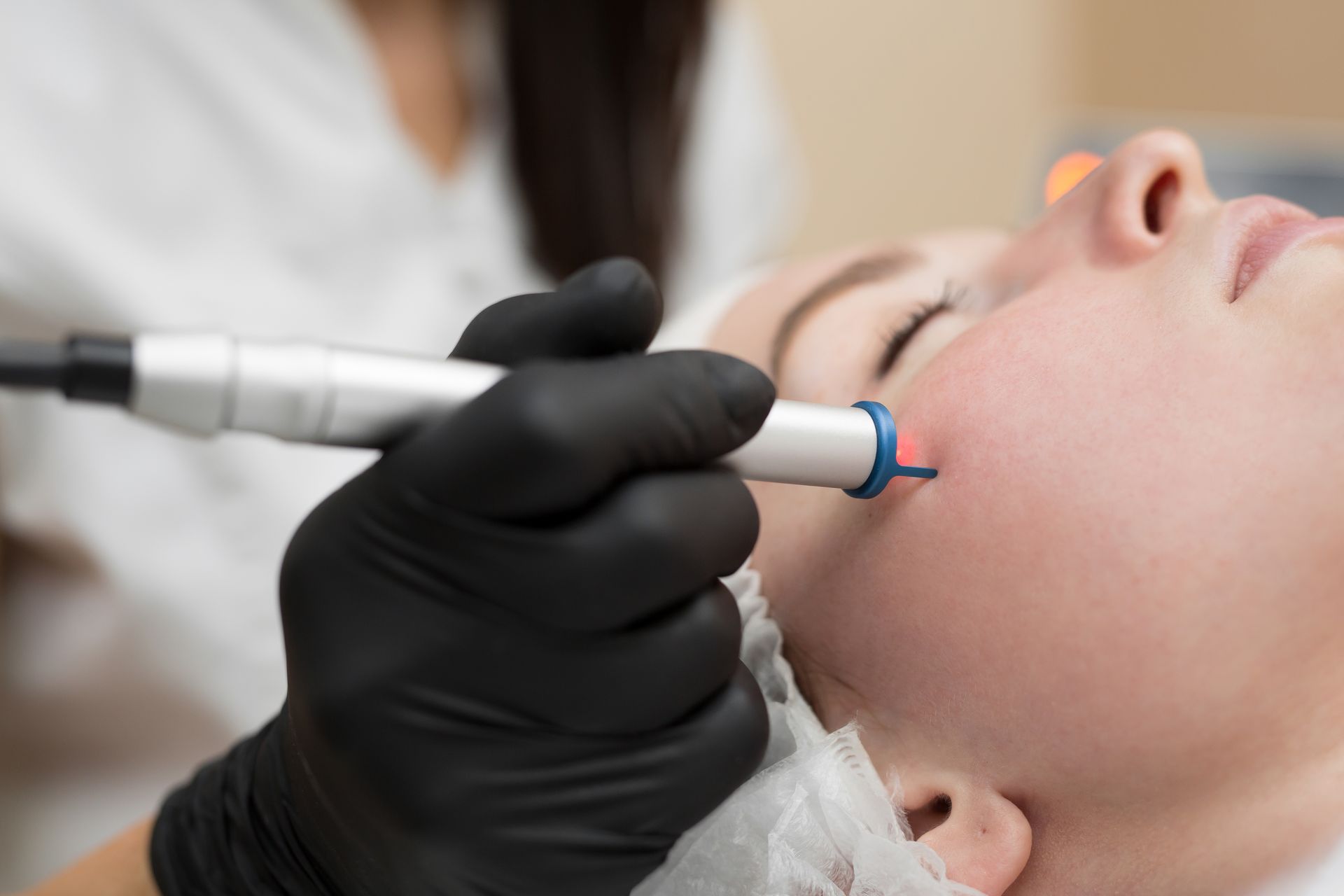 Laser CO2 frazionato